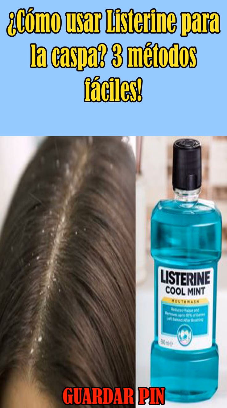 ¿Cómo se aplica el enjuague bucal para la caspa?