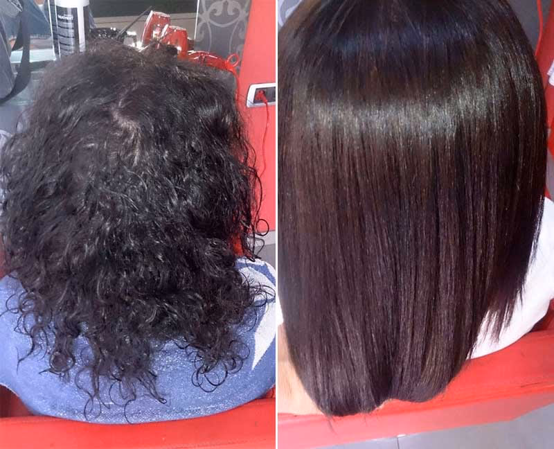 ¿Cuánto cuesta un tratamiento de enzimoterapia?