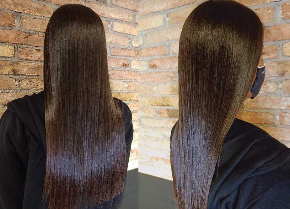 ¿Qué pasa si me echo ácido hialurónico en el cuero cabelludo?