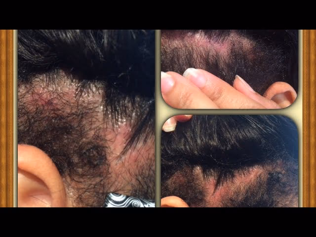 ¿Cuáles son los problemas con las extensiones?