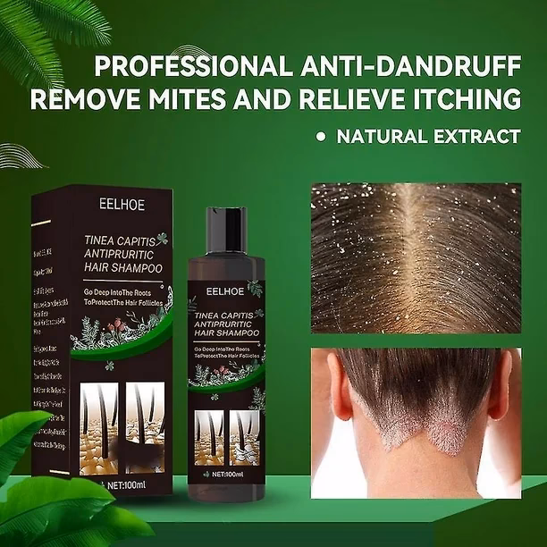 ¿Qué champú combate la seborrea?