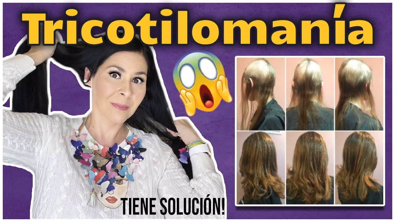 ¿Cómo quitar la manía de arrancarse el cabello?