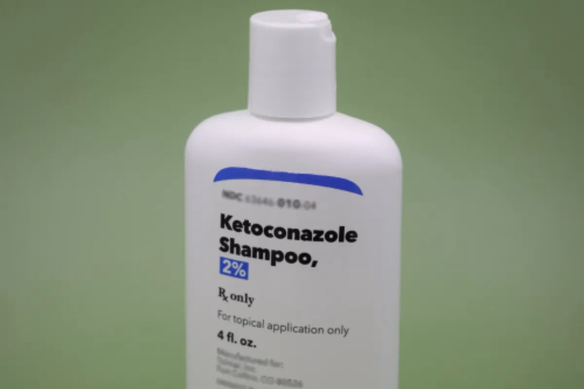 ¿Es efectivo el champú con ketoconazol para la caída del cabello?