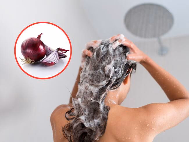 ¿Qué contraindicaciones tiene la cebolla?