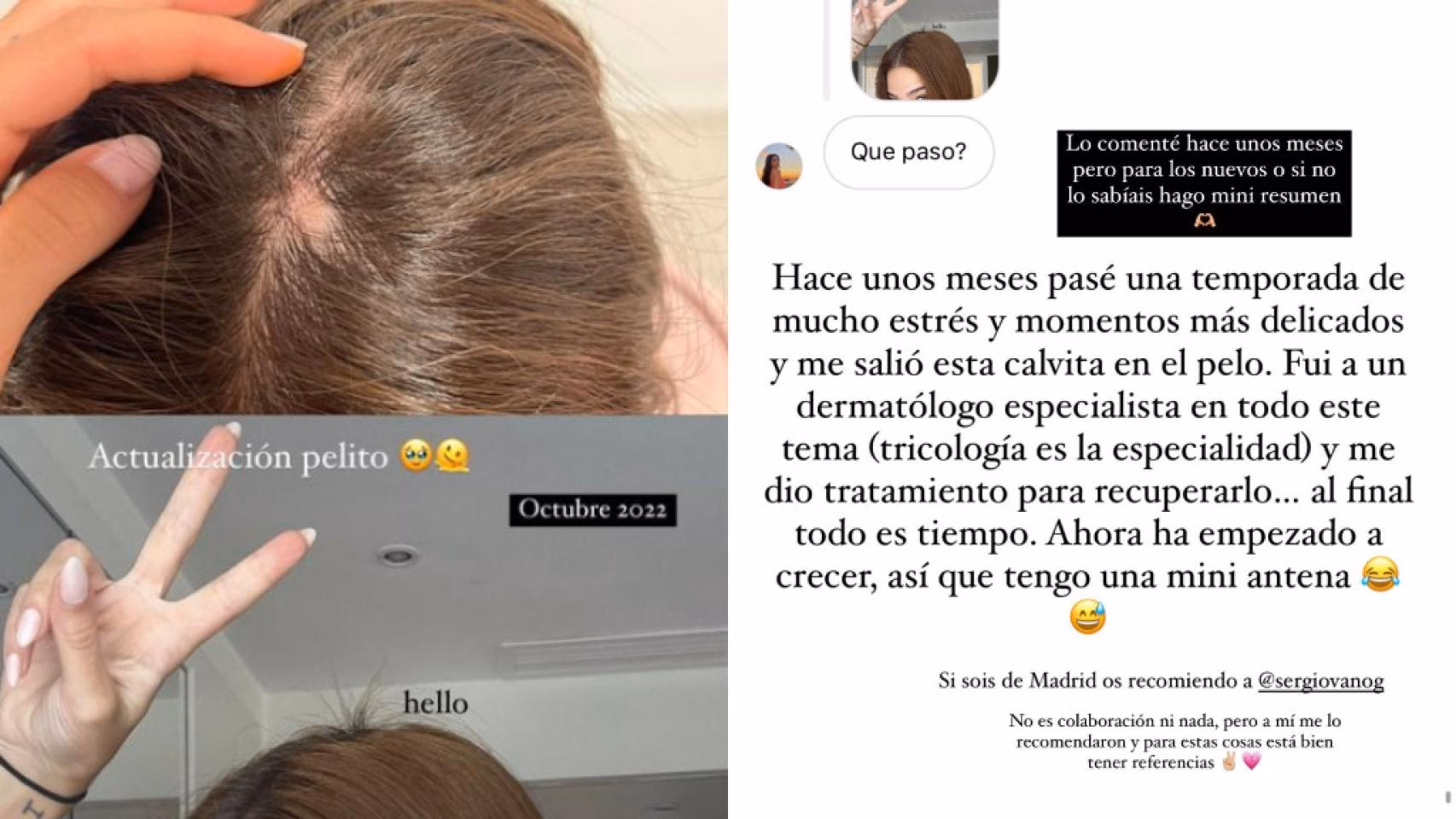 ¿Cómo se llama el especialista que ve la caída de cabello?