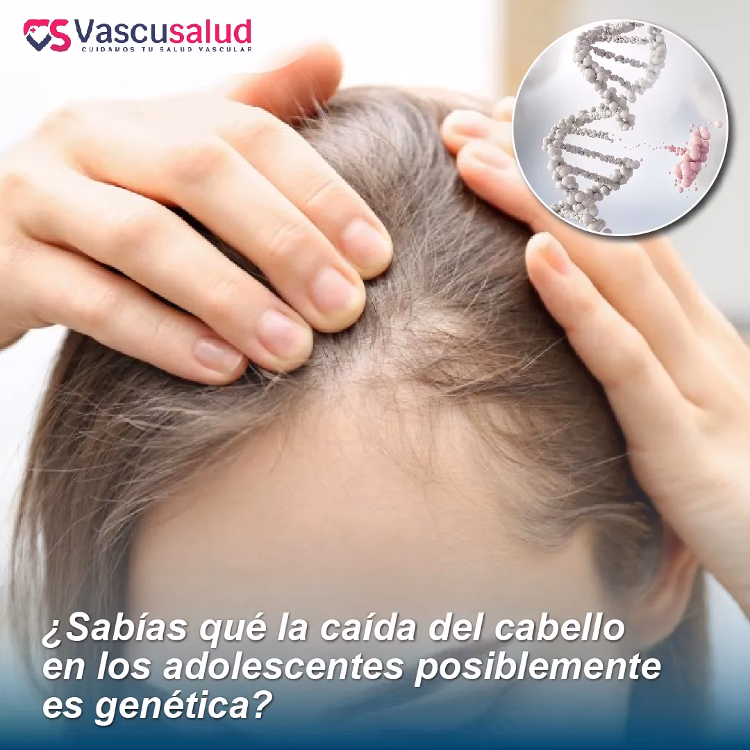 ¿Cuáles son las causas de la caída del cabello en los hombres jóvenes?