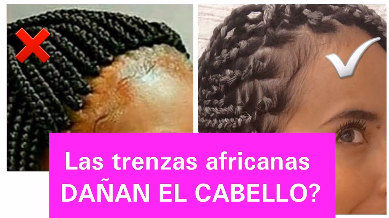 ¿Qué consecuencias tienen las trenzas africanas?