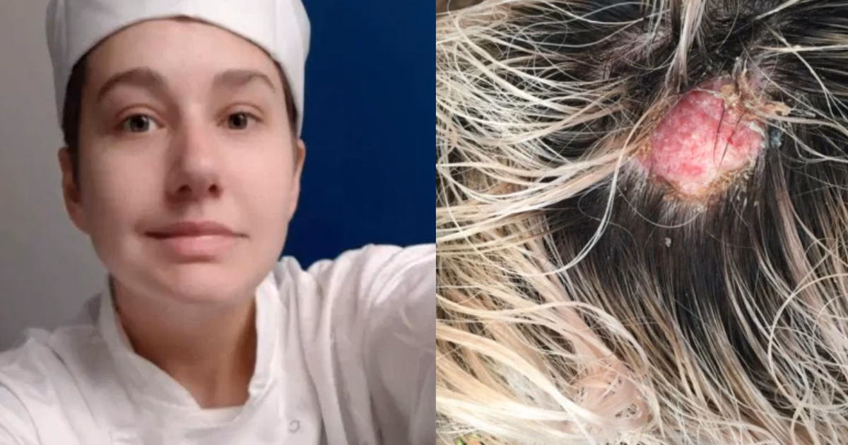 ¿Cómo hacer para que no arda la decoloración?