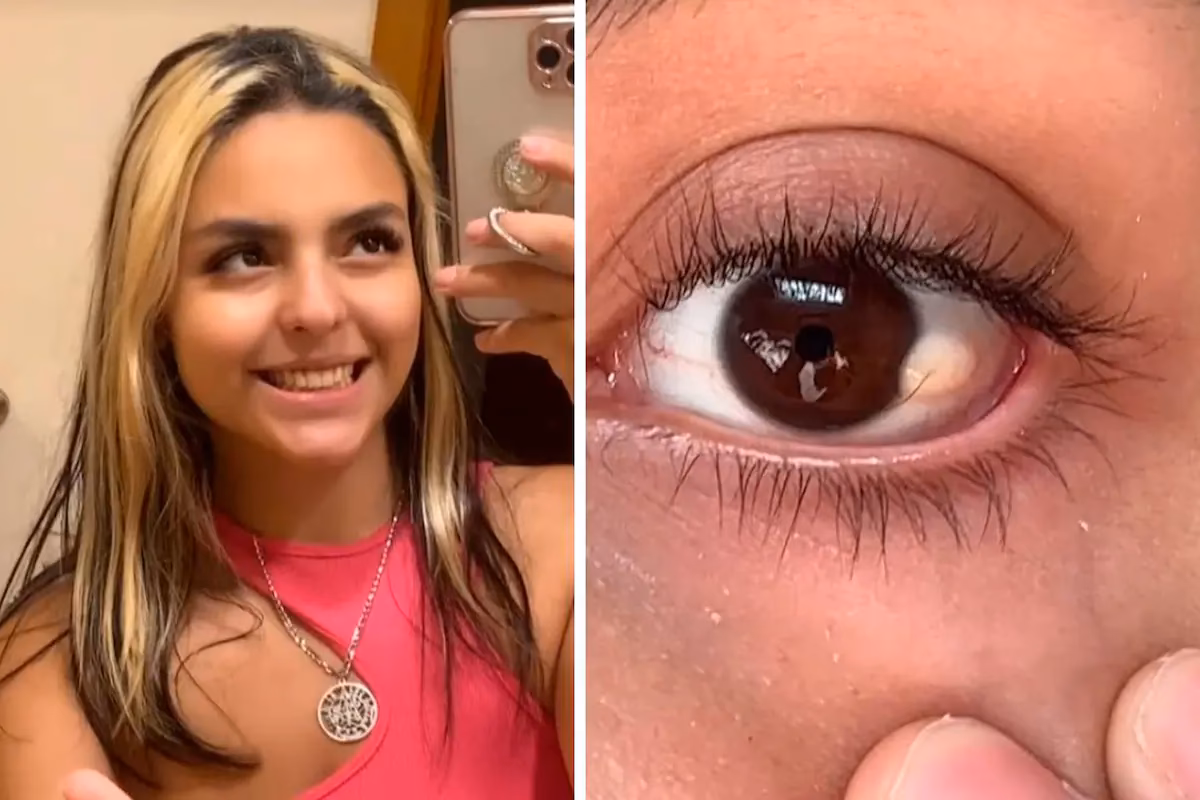 ¿Qué pasa si te entra tinte en el ojo?