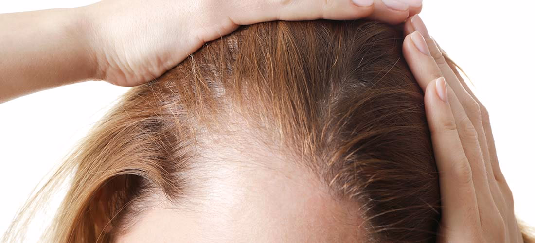 ¿Qué hacer si tengo un poco de entradas?