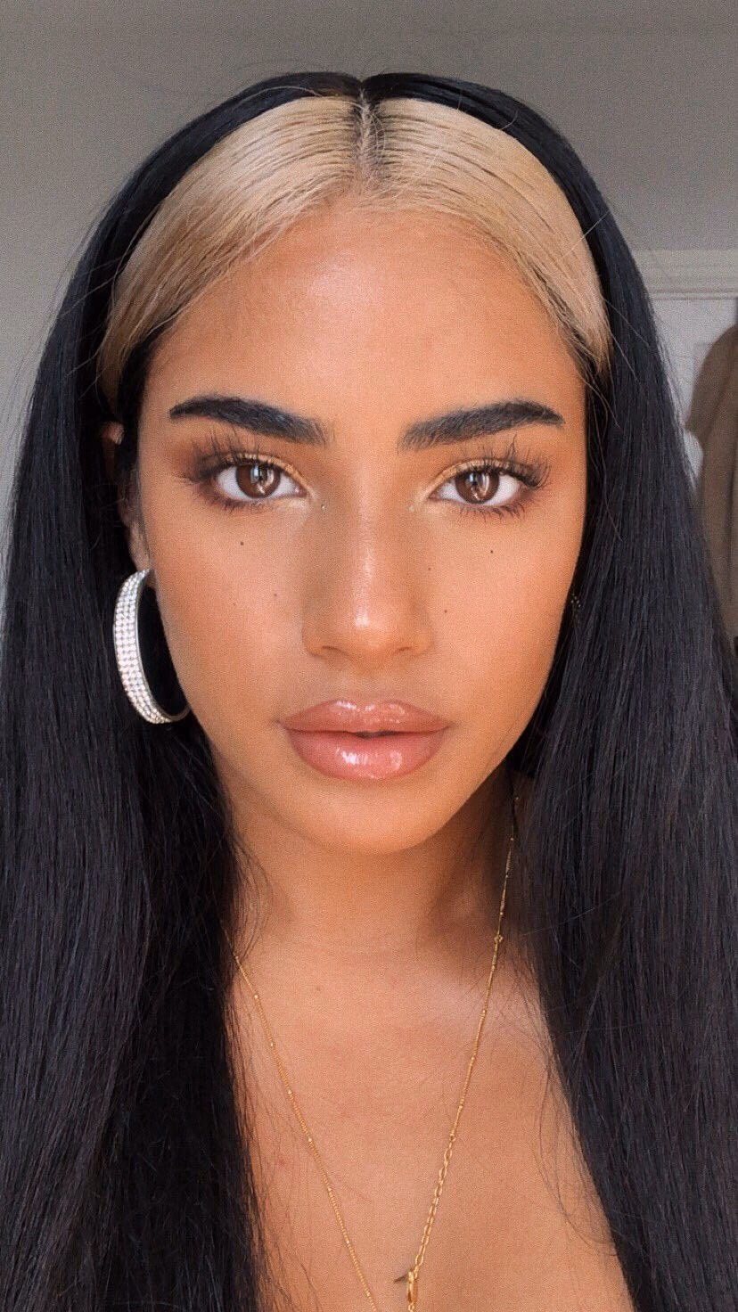 ¿Qué es el mechón de pelo que tengo en la frente?