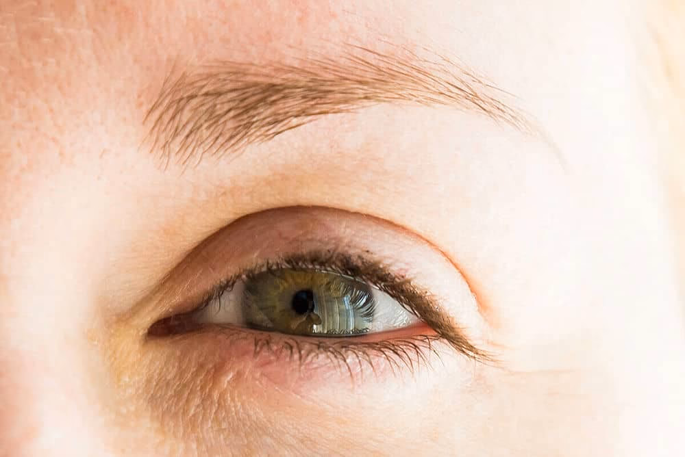 ¿Qué causa la caída del cabello en las cejas?