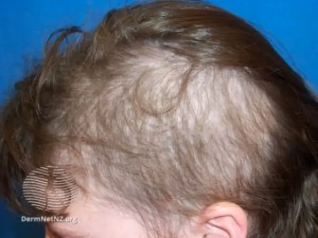 ¿Qué hacer si tu hijo se tira del pelo?