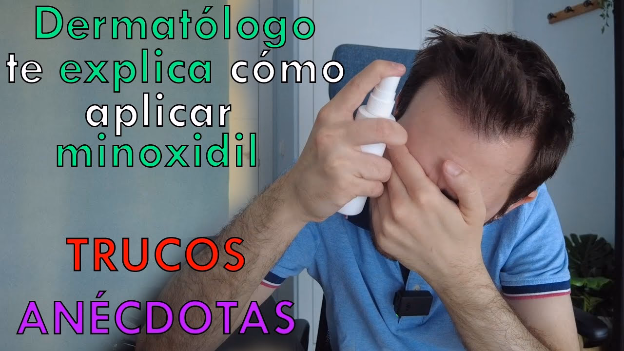 ¿Cuánto tiempo se debe dejar el minoxidil en la cabeza?