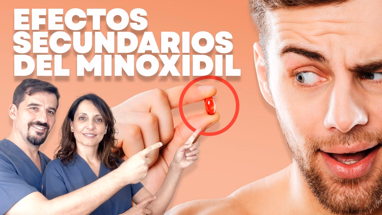¿A qué órganos afecta el minoxidil?