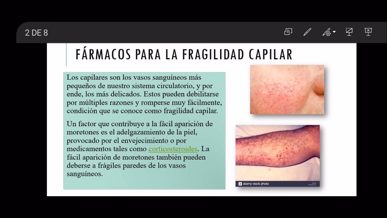 ¿Qué crema es buena para la fragilidad capilar?