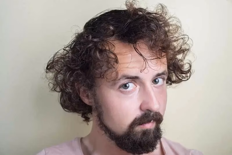 ¿Qué produce el exceso de grasa en la cara?