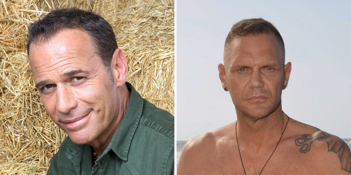 ¿Qué operación se hizo Nacho Vidal?