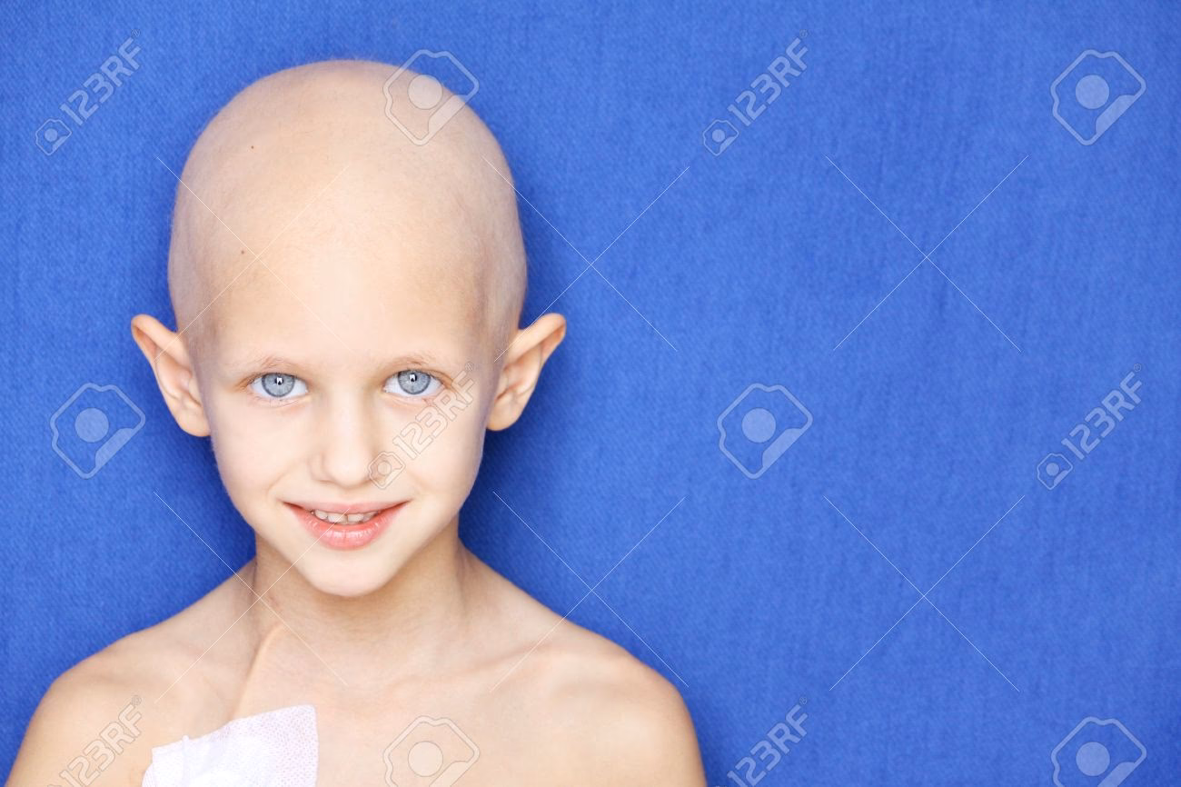 ¿Puede el cáncer provocar pérdida de cabello en los niños?