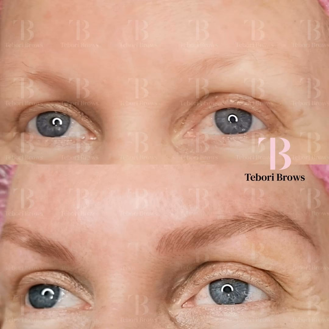 ¿Qué significa que se me caiga el pelo de las cejas?