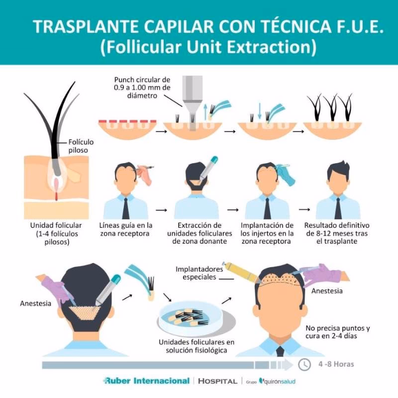 ¿Cuáles son las etapas de un injerto?