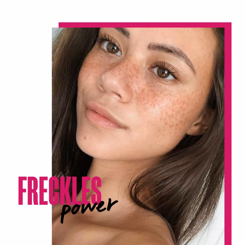 ¿Qué color de cabello tiene más pecas?