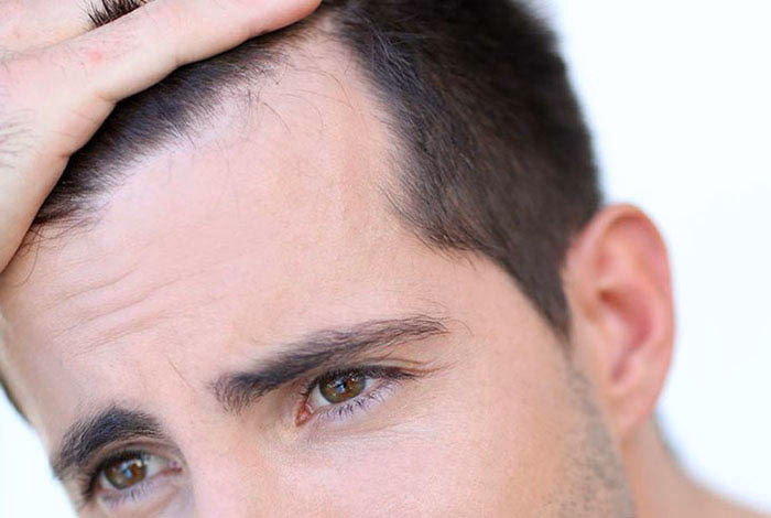 ¿Cómo se llama el mechón de pelo que cae sobre la sien?