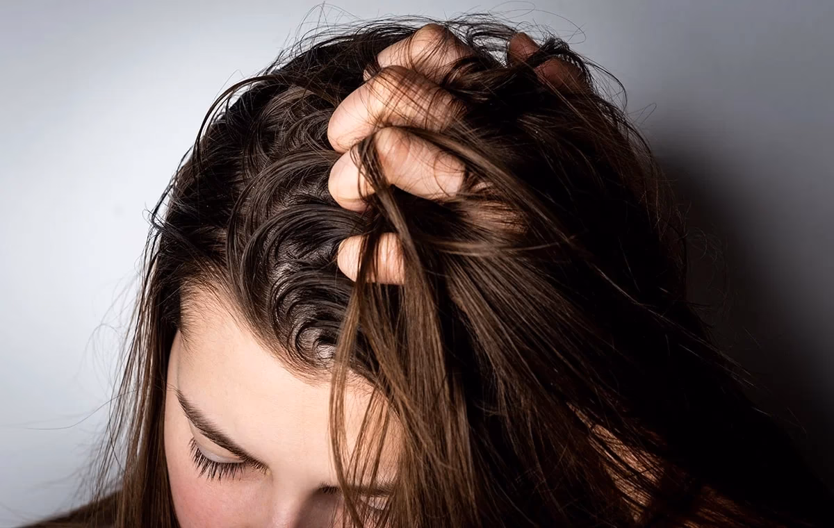 ¿Cuáles son las causas del exceso de grasa en la cabeza?