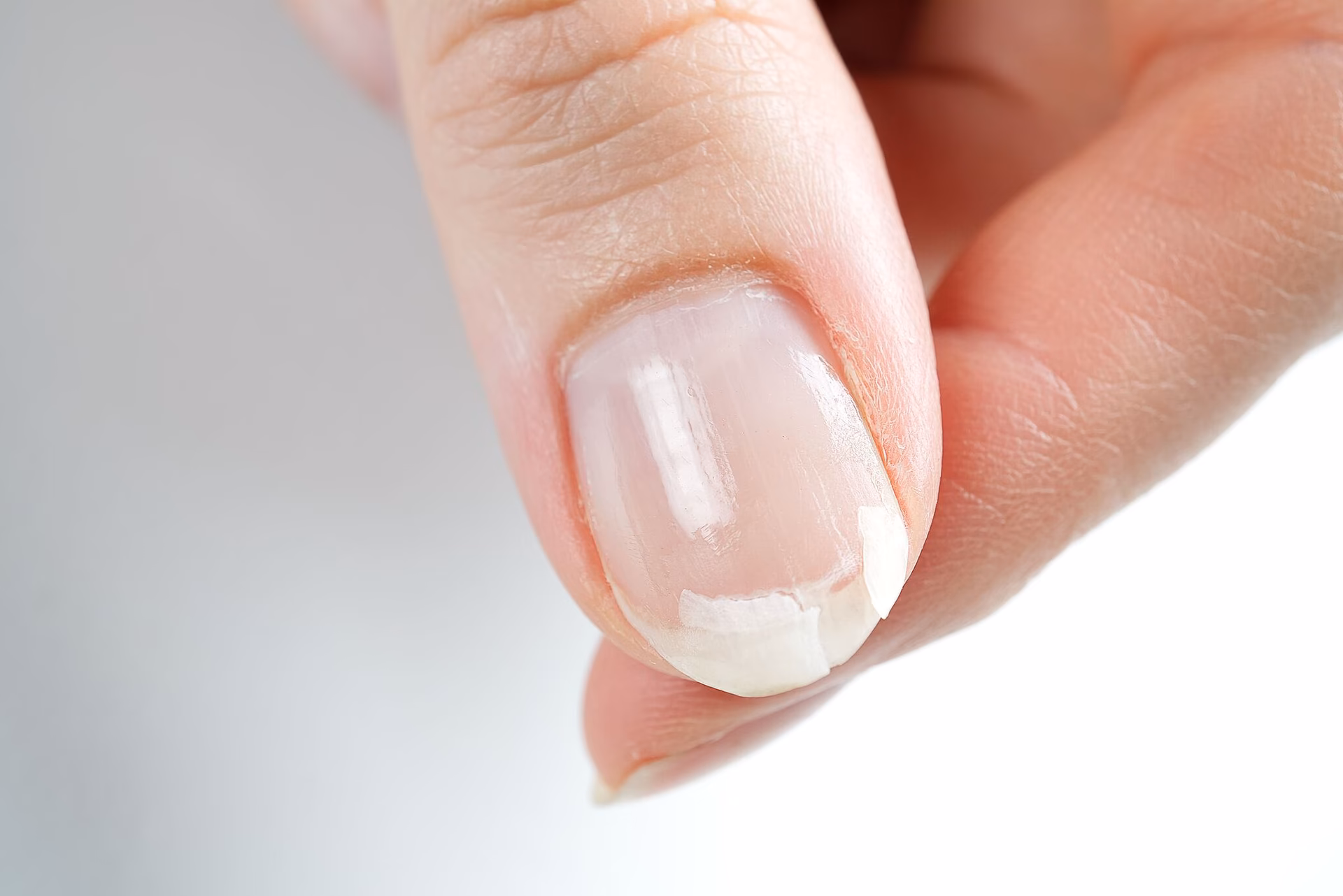 ¿La uña es uña célula muerta?