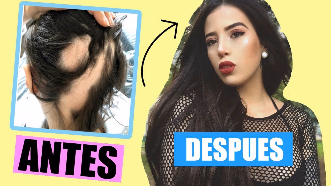¿Cómo detener la caída del cabello después de la decoloración?