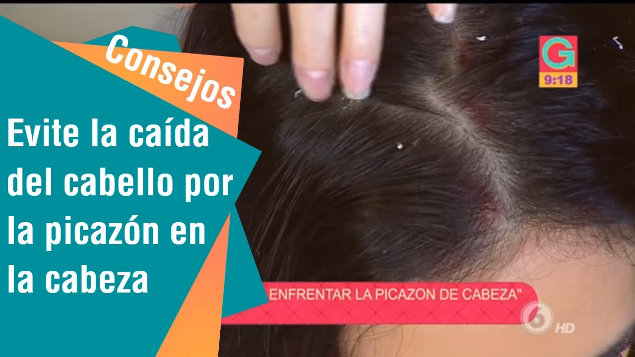 ¿Por qué tengo picazón y se me cae el cabello?