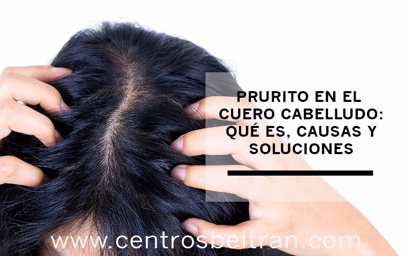 ¿Por qué me pica la cabeza y se me cae el pelo?