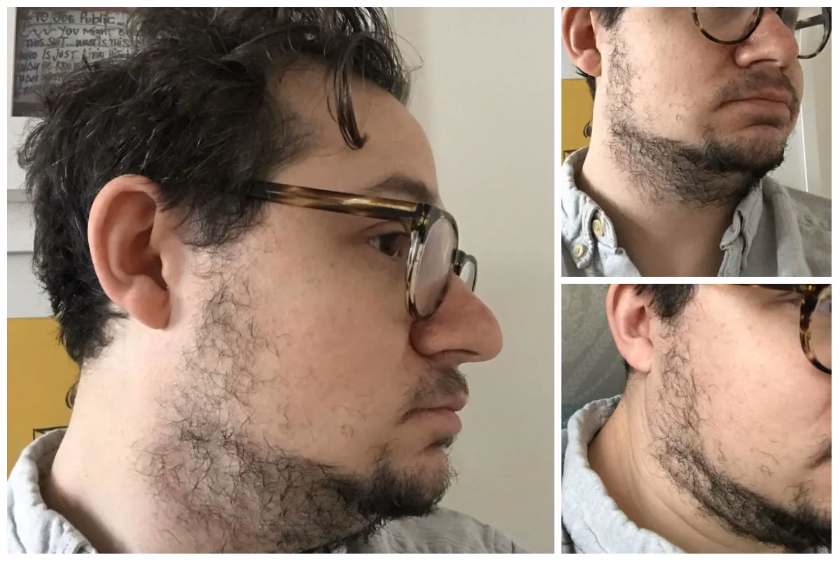 ¿Cómo saber si tengo buena genética para la barba?