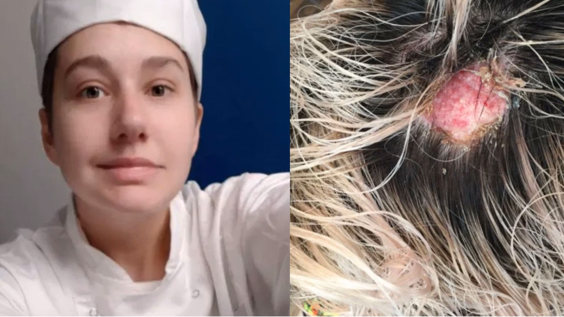 ¿Cómo prevenir quemaduras en el cuero cabelludo por la decoloración?