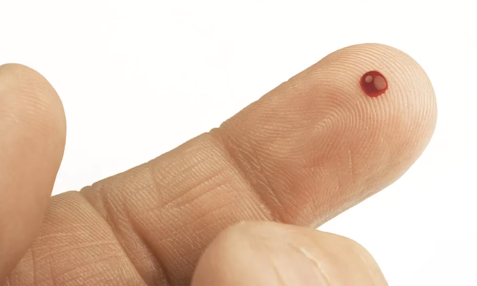 ¿Qué es una muestra capilar de sangre?