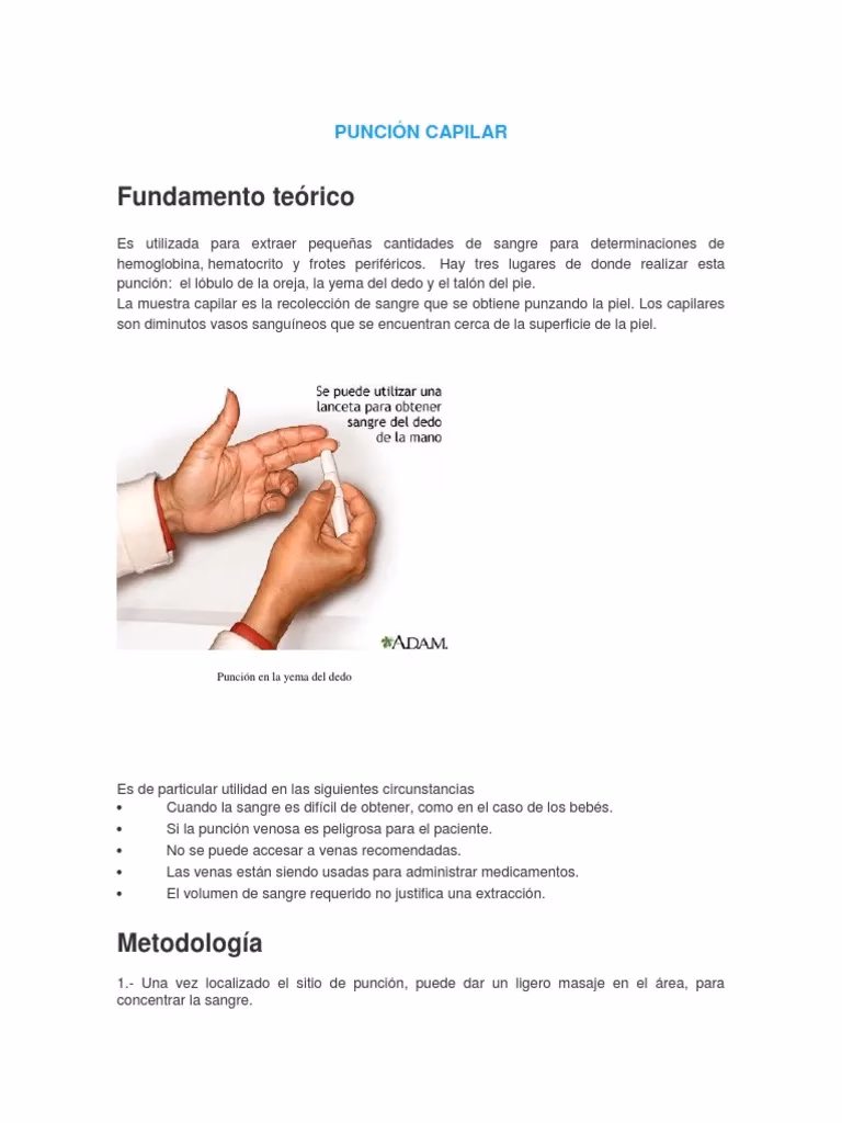 ¿Cuáles son las desventajas de la punción cutánea?