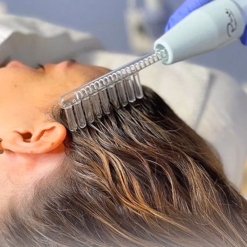 ¿Cuáles son las contraindicaciones de la alta frecuencia capilar?