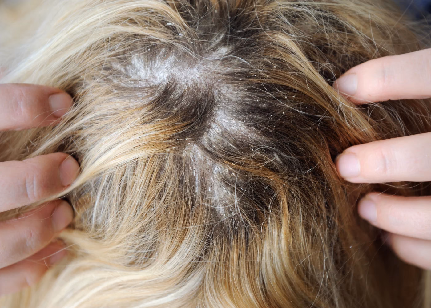 ¿Qué quiere decir libre de parabenos?