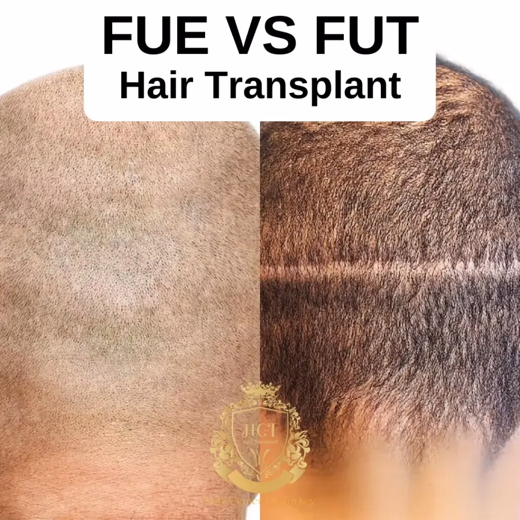 ¿Cuáles son los alcoholes malos para el cabello?