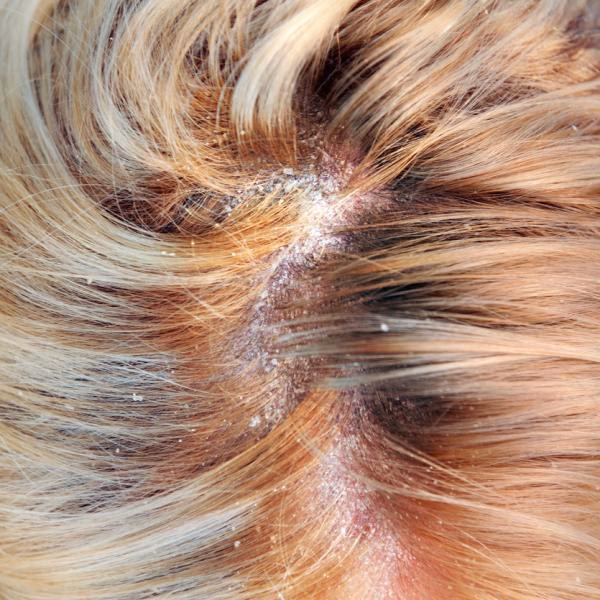 ¿Qué pasa si no me seco el cabello después de bañarme?