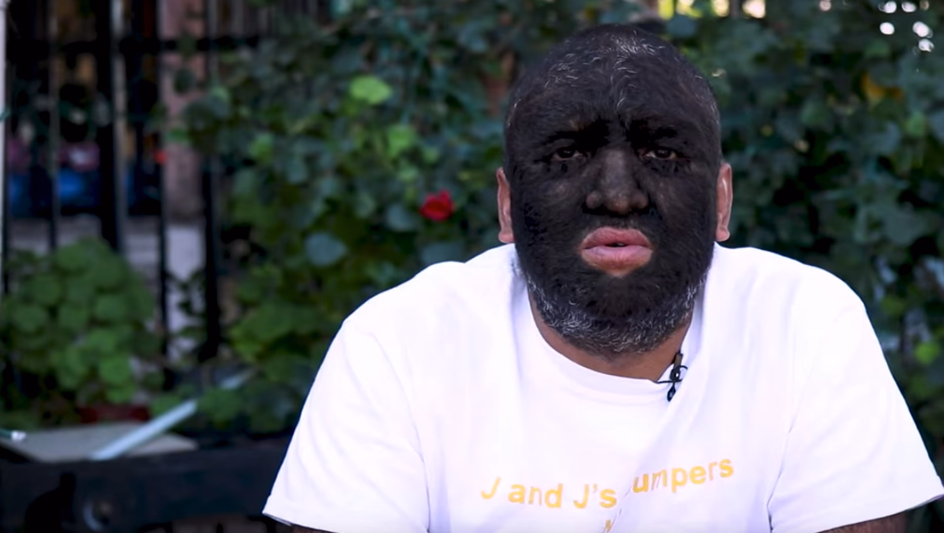 ¿Cómo se llama el pelo que nace en la cara?