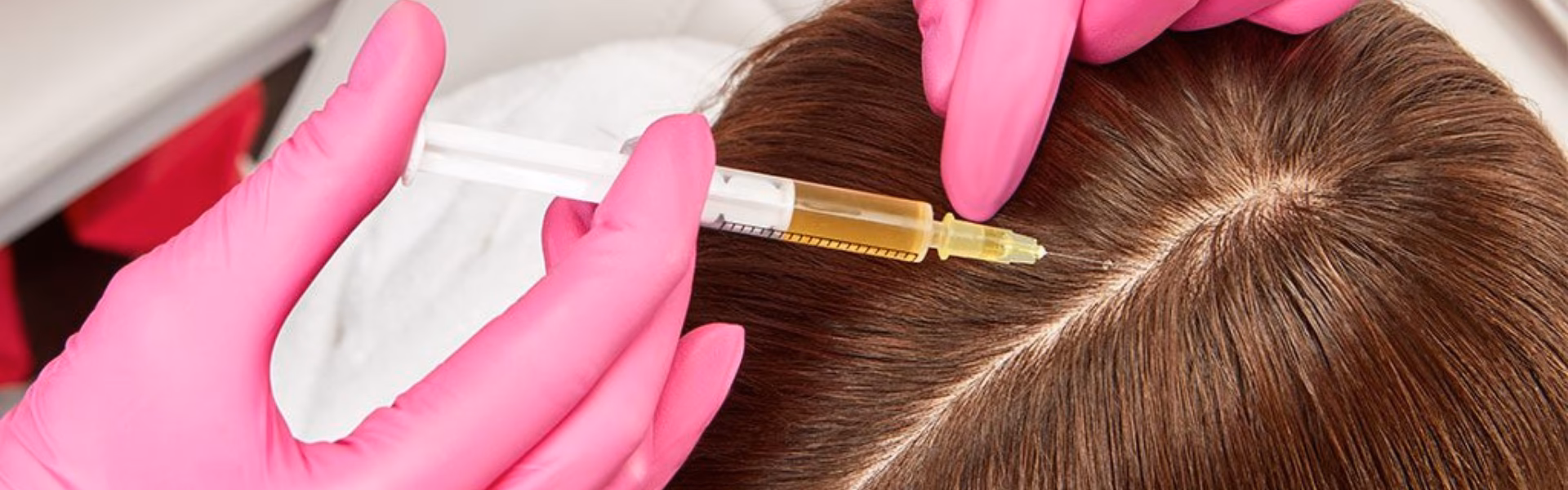 ¿Funciona la regeneración del cabello con células madre?