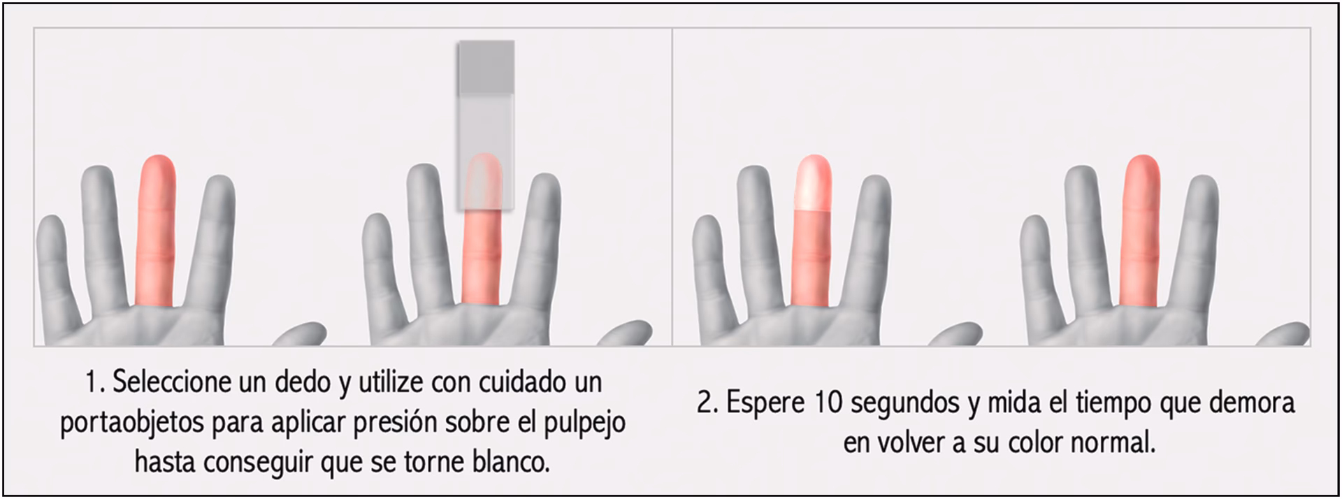 ¿Qué significa llenado capilar menor a 2 segundos?
