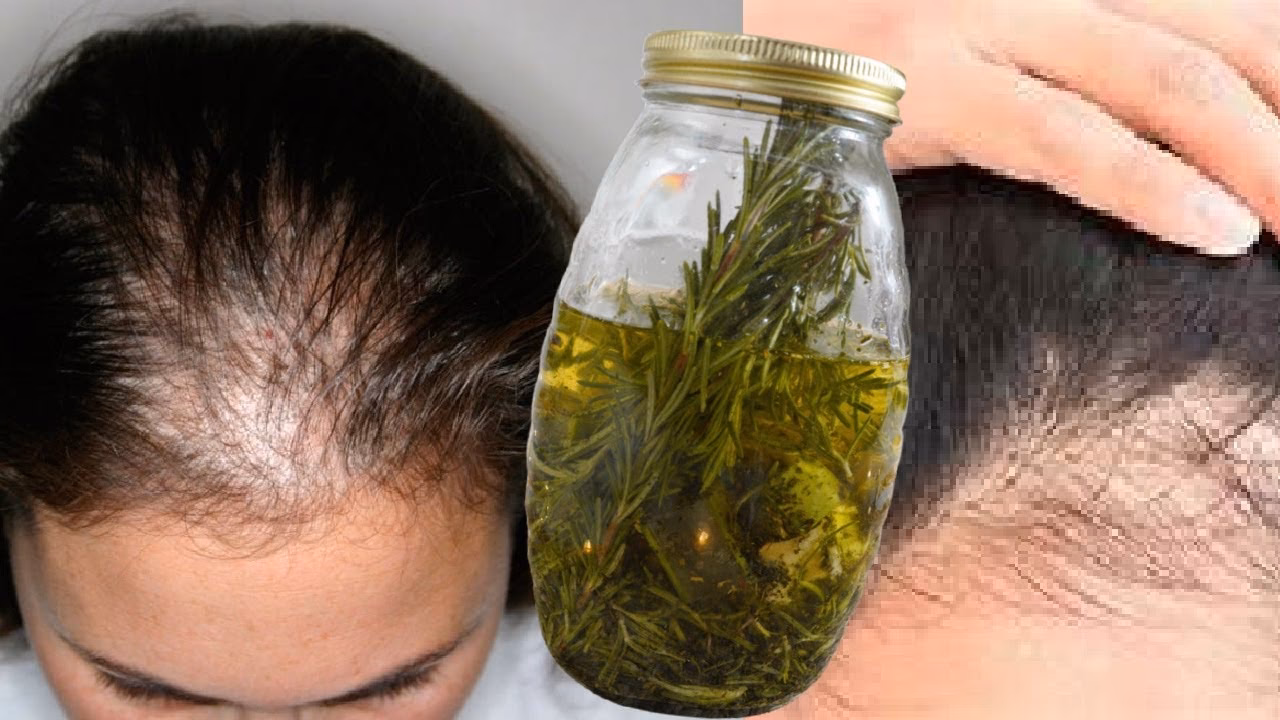 ¿Qué puedo tomar para la caída del cabello durante el embarazo?