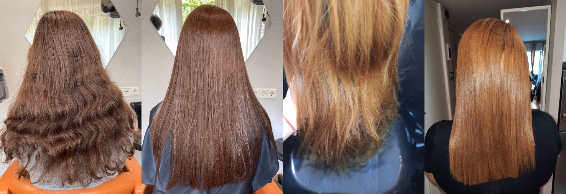 ¿Cuándo comienzo a ver los resultados del bótox?