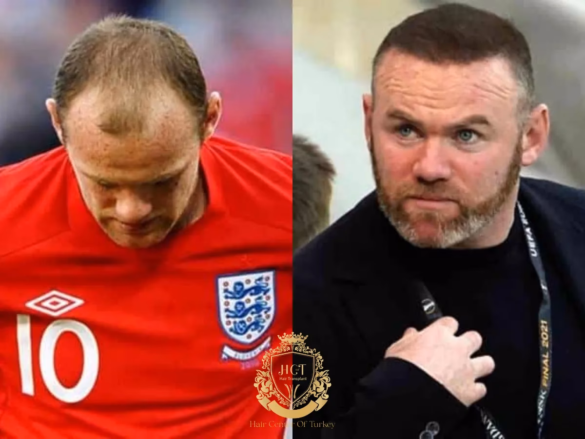 ¿Qué hizo Wayne Rooney con su cabello?