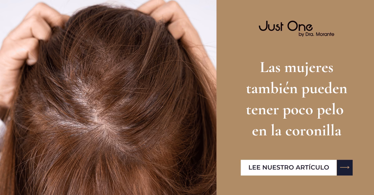 ¿Cómo evitar que el cabello se parta en la coronilla?