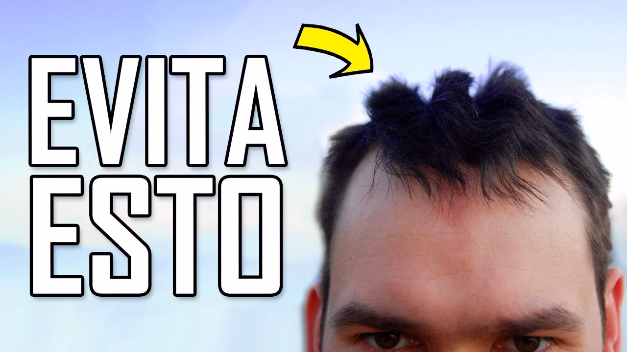 ¿Por qué me salen pelos por el casco?