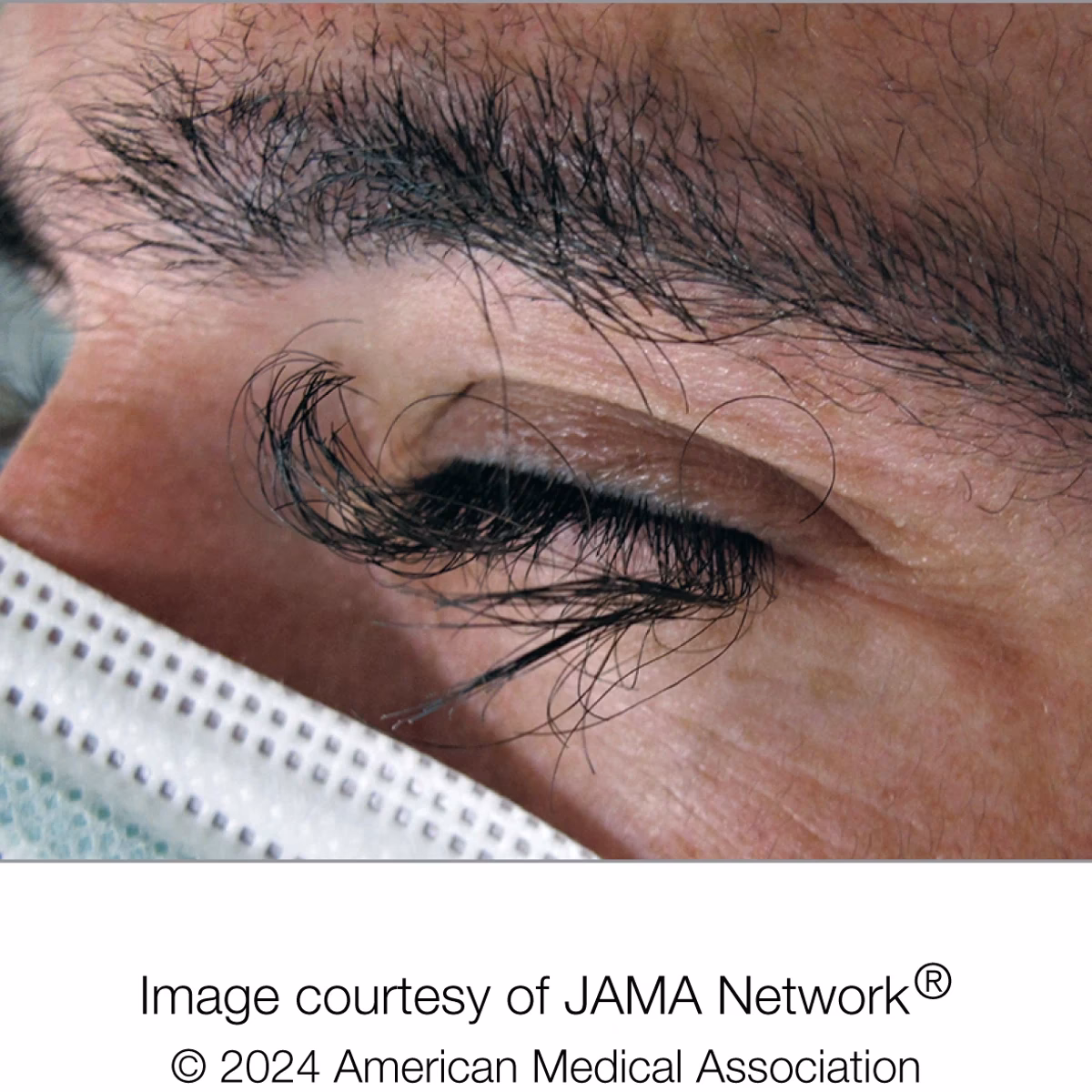 ¿Cómo se llama el síndrome cuando no crecen?