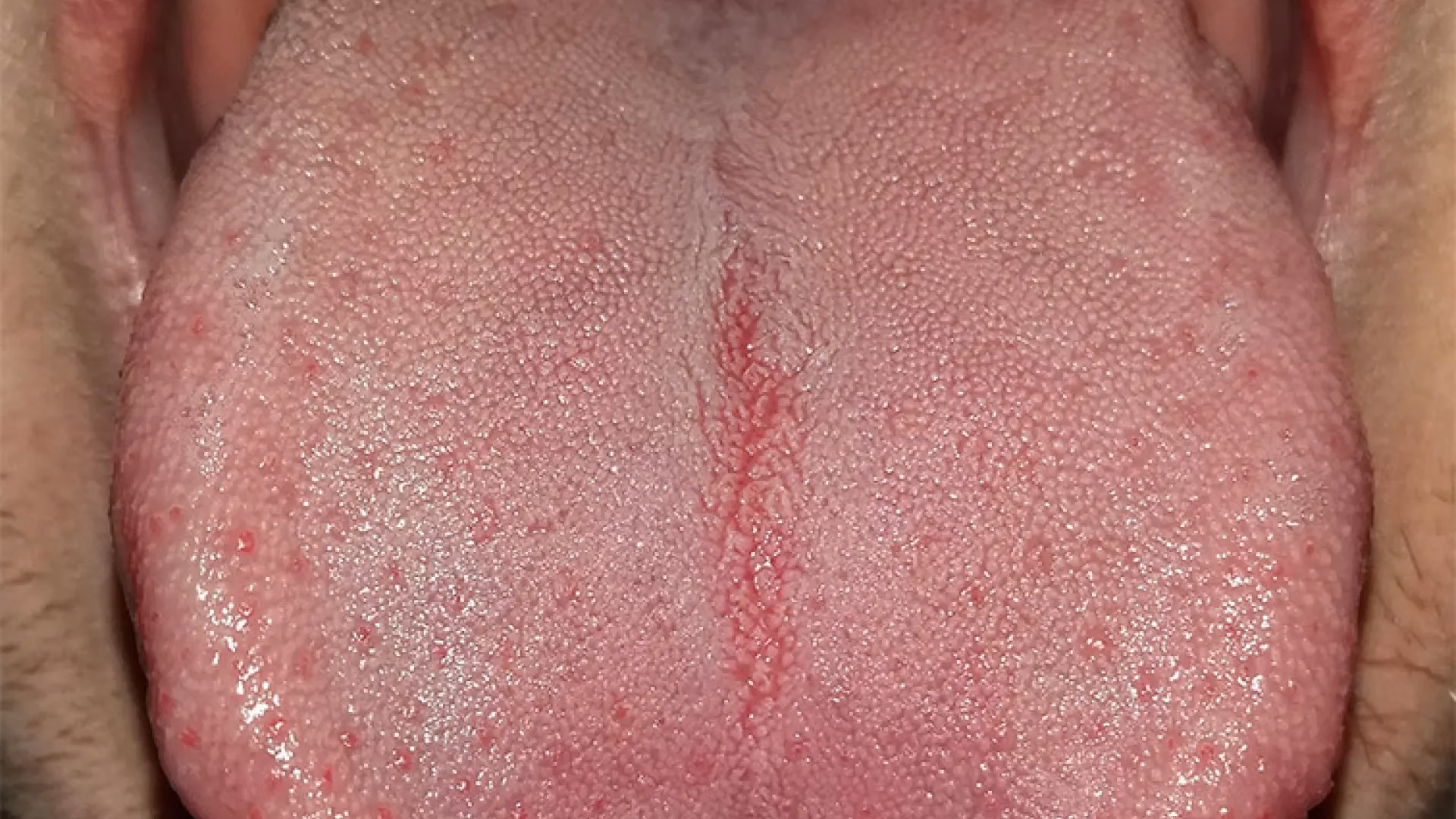 ¿Cómo quitar los pelitos de la lengua?